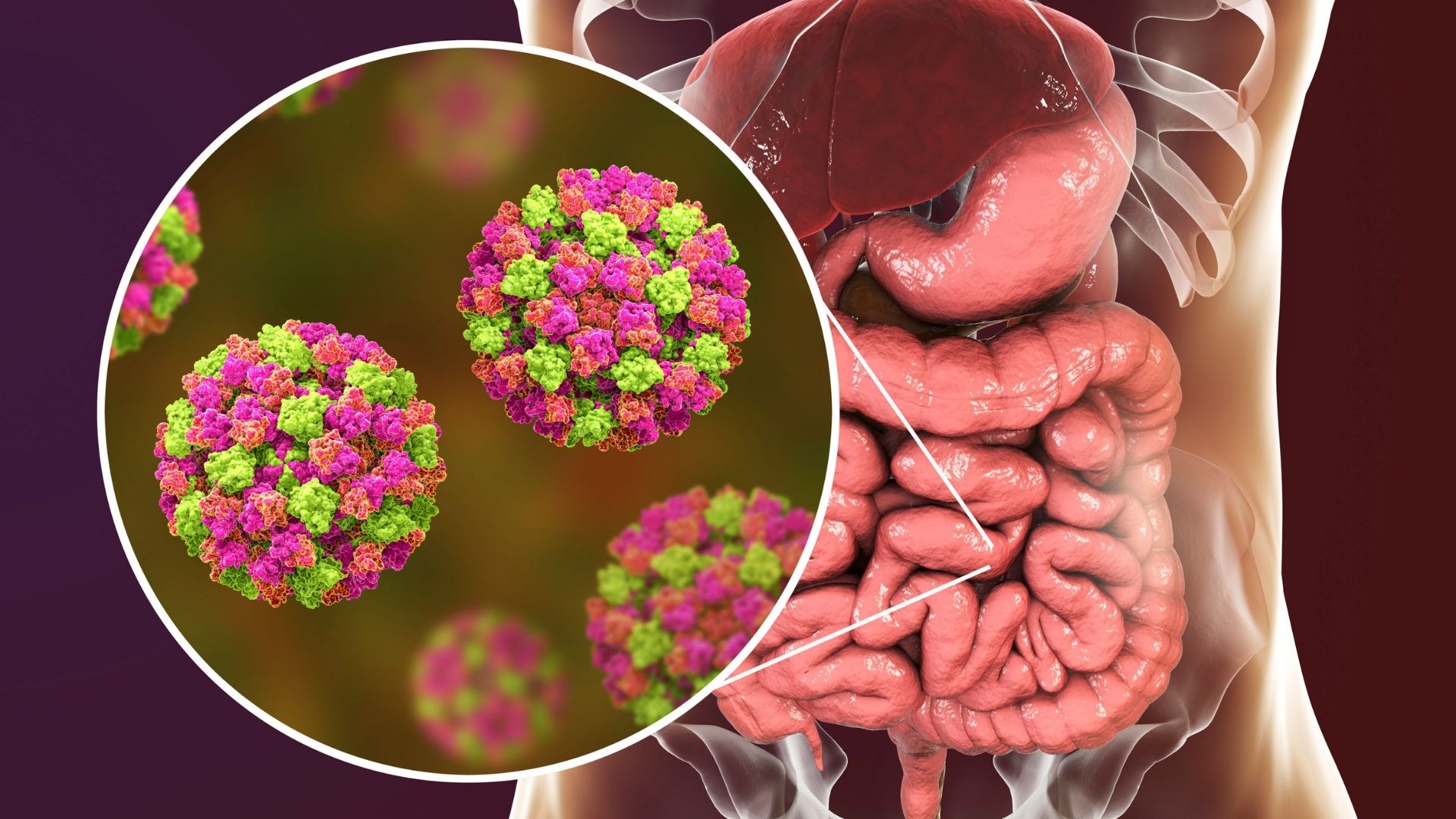 Gastroenterit (İshal) Salgını Gerçek mi? Artan Vakalara Beslenme Önerileri